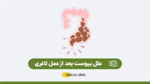 یبوست بعد از عمل لاغری