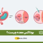 عکس بوتاکس معده