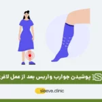 عکس جوراب واریس بعد از عمل لاغری