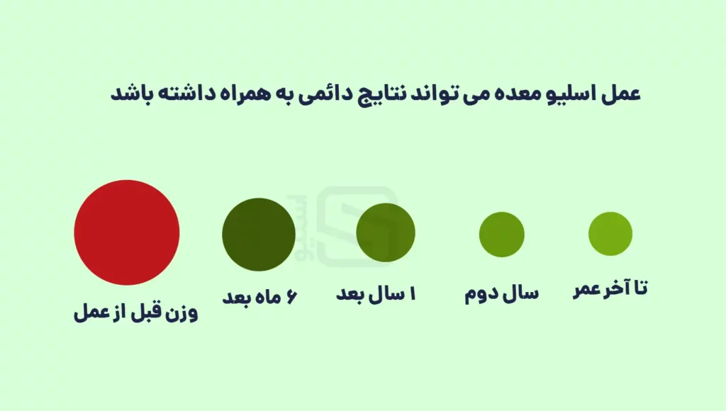 اینفوگرافی شماتیک روند کاهش وزن بعد از عمل اسلیو معده