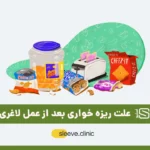 ریزه خواری بعد از عمل لاغری