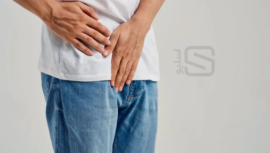 علائم واریکوسل در اطراف شکم