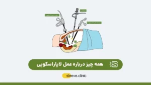 عمل لاپاراسکوپی