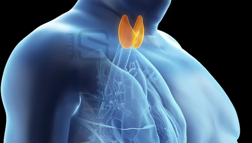 تصویر شماتیک یک مرد چاق که در آن جایگاه غده تیروئید مشخص شده است