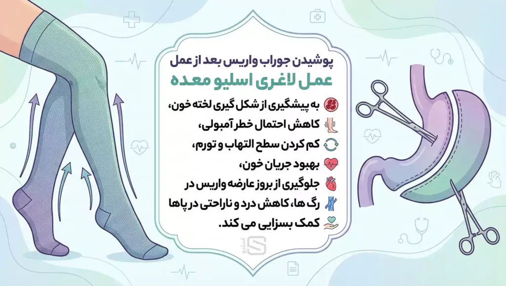 مزیت های پوشیدن جوراب واریس بعد از عمل لاغری اسلیو معده