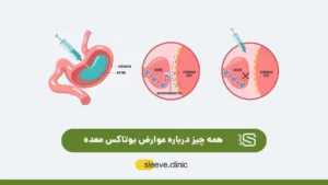 عوارض بوتاکس معده عکس