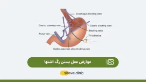 عکس شاخص بستن رگ اشتها