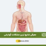مشکلات گوارشی شایع