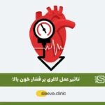 درمان فشار خون بالا با عمل لاغری شاخص