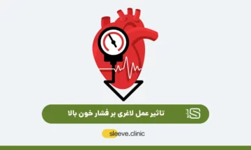 درمان فشار خون بالا با عمل لاغری شاخص