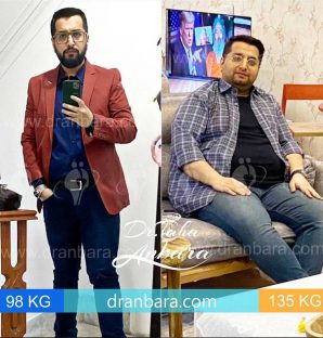 تصویر بیماران پس از عمل اسلیو