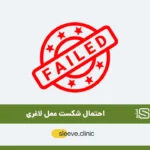 احتمال شکست عمل لاغری چقدر است شاخص