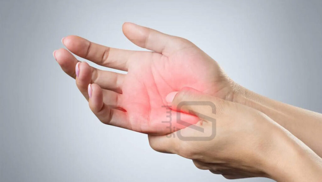 عکس از نوروپاتی محیطی