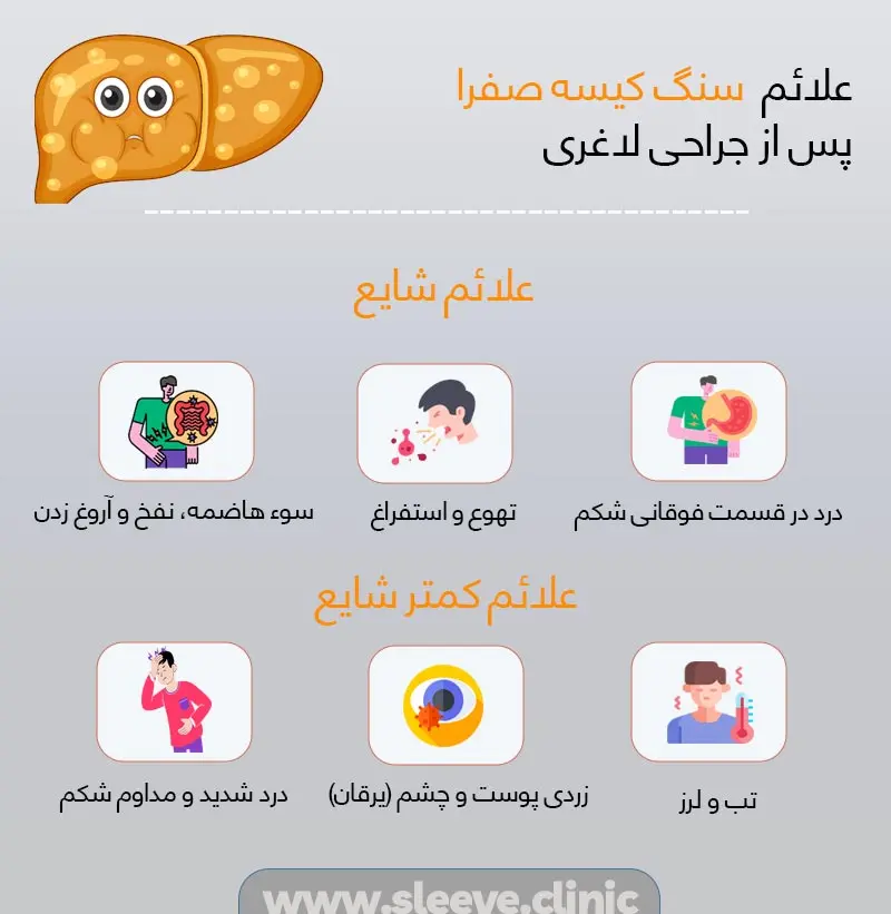 علائم سنگ کیسه صفرا پس از جراحی لاغری