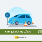 رانندگی بعد از عمل اسلیو معده شاخص