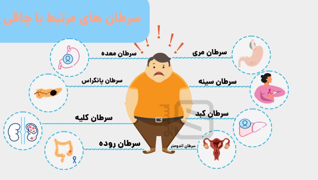 اینفوگرافی سرطان های مرتبط با چاقی