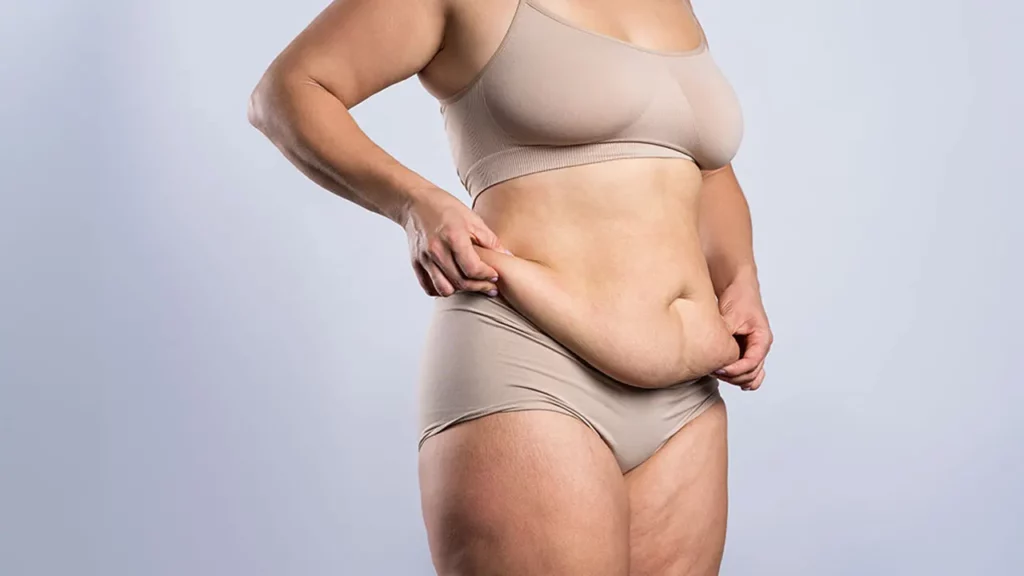 شل شدن پوست از عوارض فیزیکی عمل اسلیو