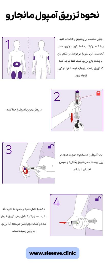 نحوه تزریق امپول مانجارو به چه صورت است؟