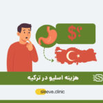 هزینه اسلیو در ترکیه