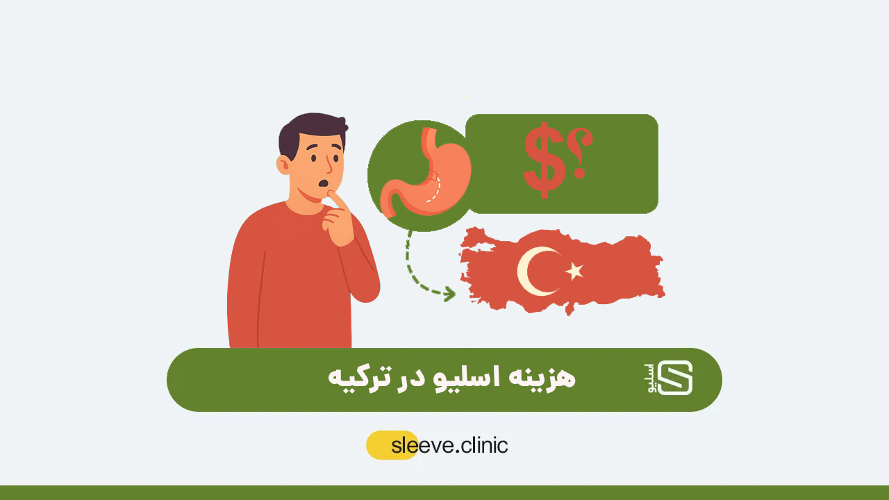 هزینه اسلیو در ترکیه