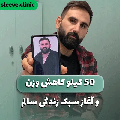 نمونه کار درمان چاقی شدید با جراحی لاغری توسط دکتر علیرضا خلج
