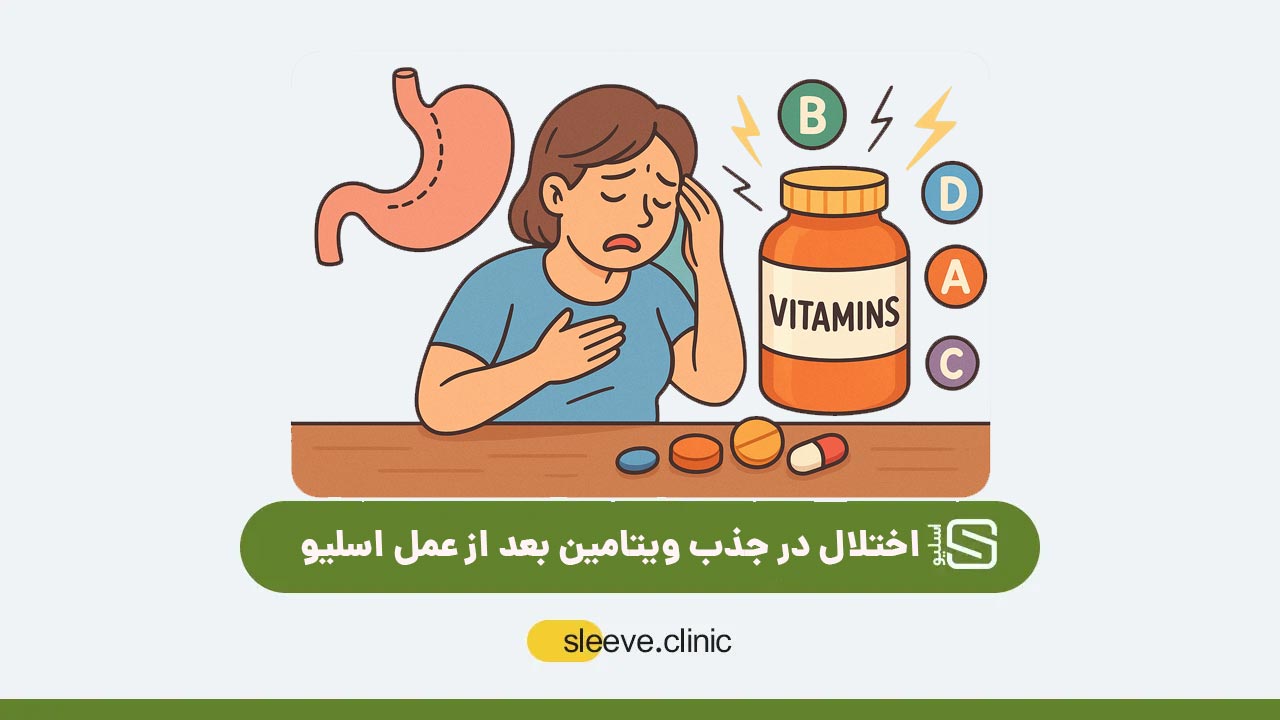 اختلال در جذب ویتامین بعد از عمل اسلیو
