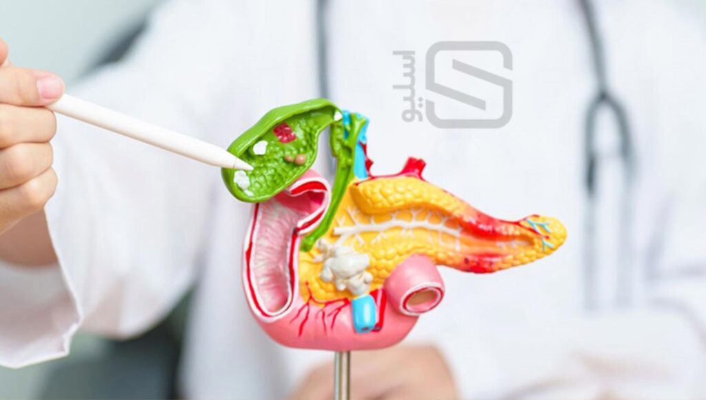 التهاب پانکراس