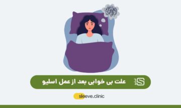 علت بی خوابی بعد از عمل اسلیو