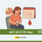 پریود بعد از عمل اسلیو