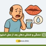 تشنگی و خشکی دهان بعد از عمل اسلیو