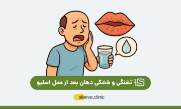 تشنگی و خشکی دهان بعد از عمل اسلیو