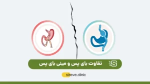 تفاوت بای پس و مینی بای پس