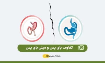 تفاوت بای پس و مینی بای پس