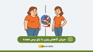میزان کاهش وزن با بای پس