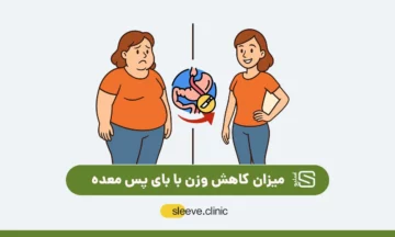 میزان کاهش وزن با بای پس