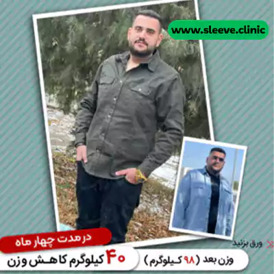 قبل و بعد نمونه کار عمل کاهش وزن دکتر طاها عنبرا