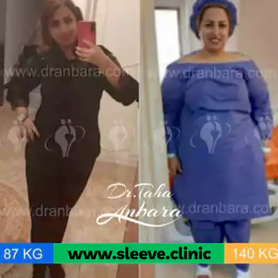 نمونه کار قبل و بعد جراحی لاغری دکتر طاها عنبرا