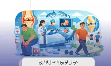 درمان آرتروز با عمل لاغری
